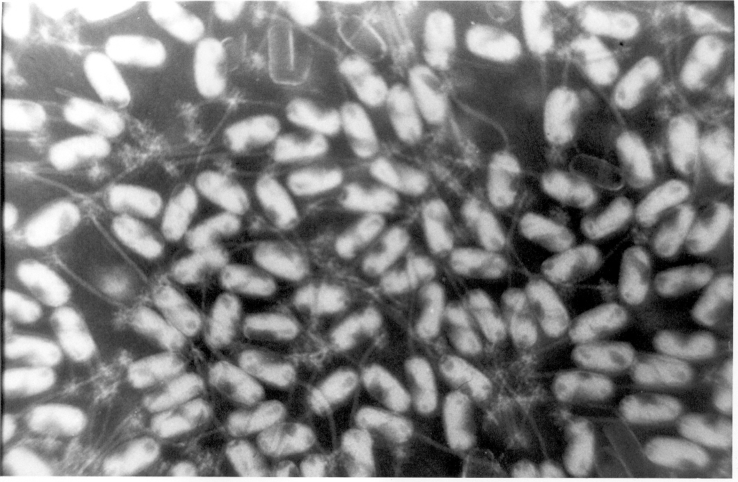 유산균L.salivarius파지.jpg